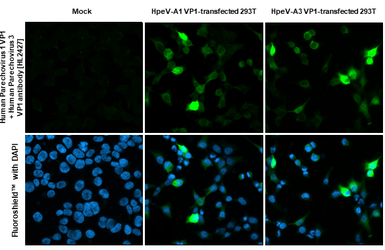 Anti-Human Parechovirus 1+3 VP1 antibody [HL2427] used in Immunocytochemistry/ Immunofluorescence (ICC/IF). GTX638649